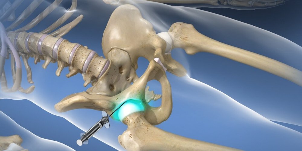 Hip Pain at Night Causes, Relief, and When to Seek Care