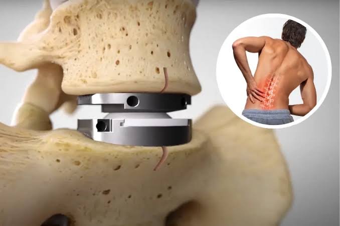 When Should You See a Neurologist or Spine Surgeon? | Brain & Spine Institute Texas
