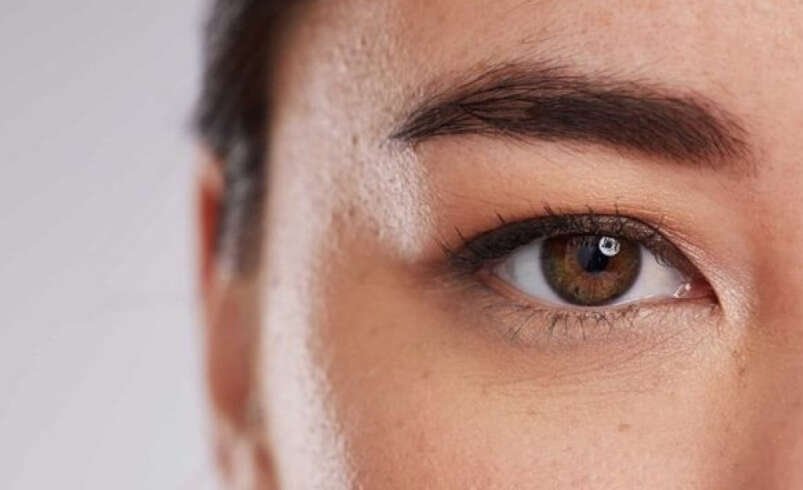 Upper Blepharoplasty Dubai: Guide to Upper Eyelid Surgery
