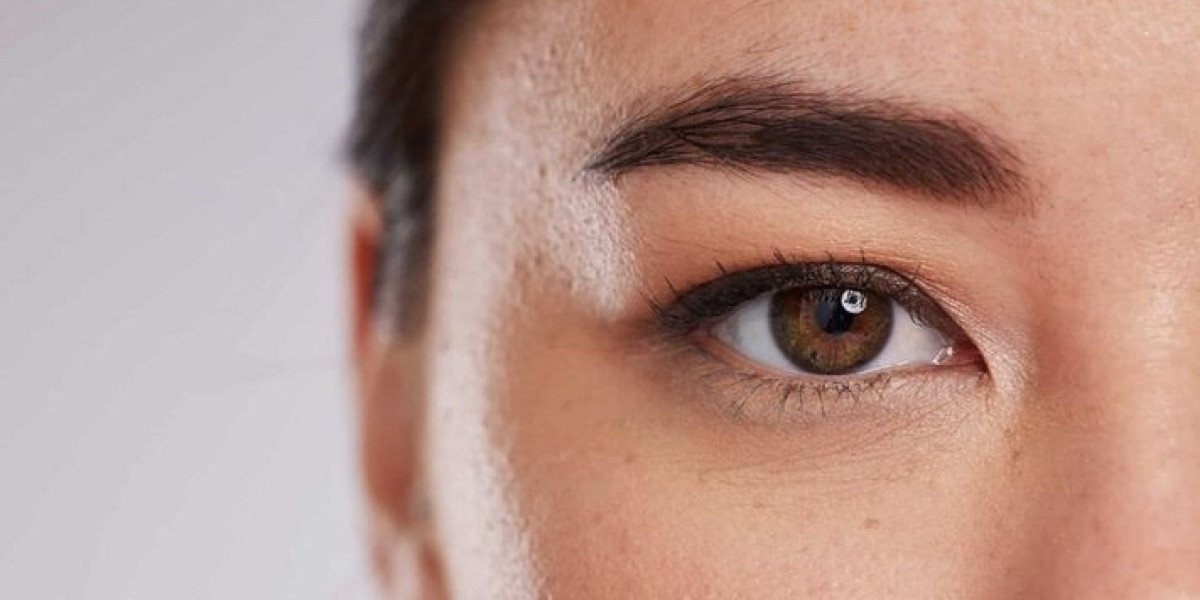 Upper Blepharoplasty Dubai: Guide to Upper Eyelid Surgery