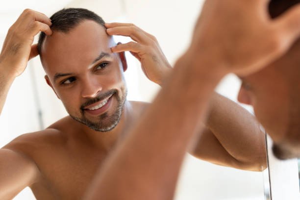 How Many Sessions Are Needed for Hair Transplant in Riyadh?