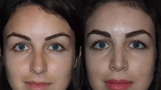 Best Rhinoplasty Surgeon in Dubai for Personalized Nose Surgery