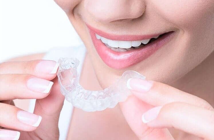 Why Aligners In Dubai Are Popular for Modern Smiles