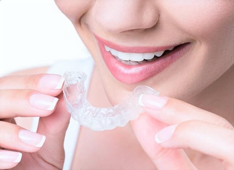Why Aligners In Dubai Are Popular for Modern Smiles