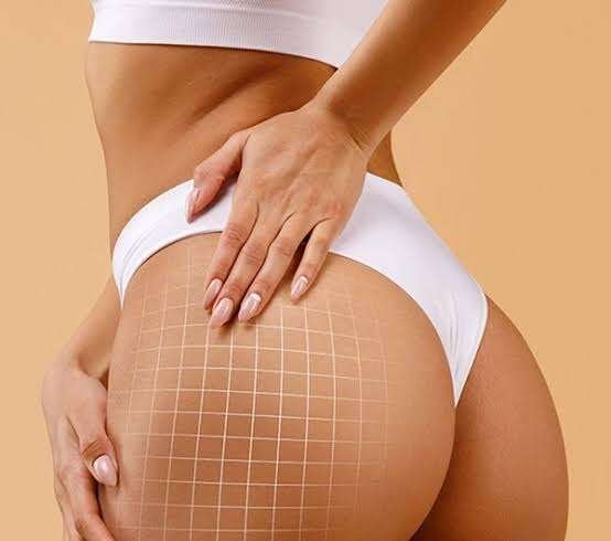 Butt Fillers In Dubai: Achieve Fuller And Refined Curves