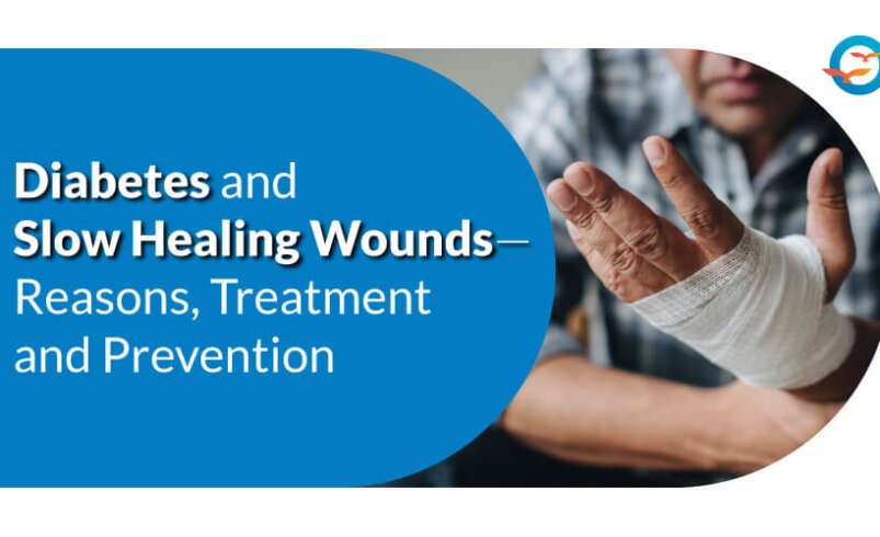 Diabetes and Wound Healing: Reasons, Treatment and Prevention