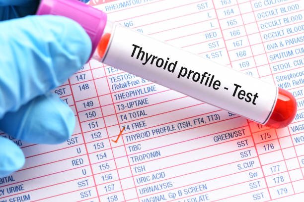 Thyroid Test in Sonitpur & Thyroid Lab Test Near Me – Modern Diagnostic & Research Center Lab
